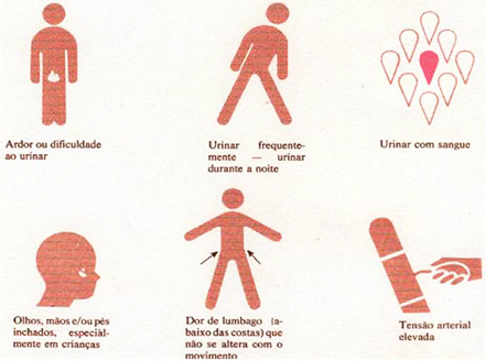 Infecção urinária saiba como se prevenir da doença que aumentou em no início do ano