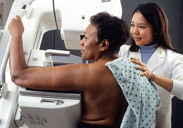 Mamografias: 30% de pacientes agendadas não vão ao exame