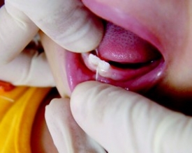 Cuidados com a higiene bucal dos bebês