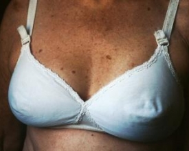 Fechando o Outubro Rosa: a vida após o câncer 