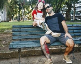 Em Cordeiro, pai tatua prótese na perna para ficar igual à filha